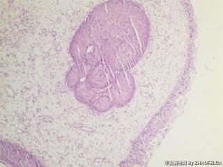 宫颈组织图5