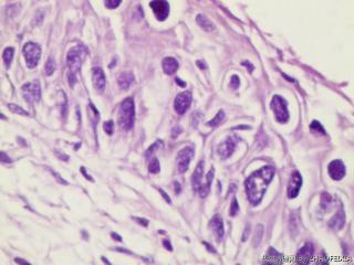 宫颈组织图15
