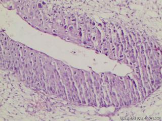 宫颈组织图14