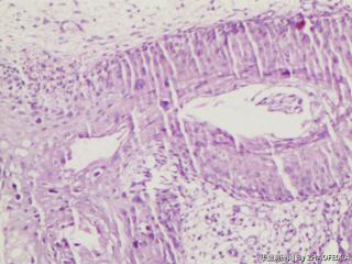 宫颈组织图12
