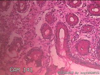 胃窦粘膜图19