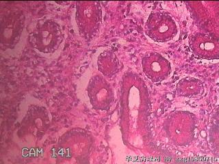 胃窦粘膜图24