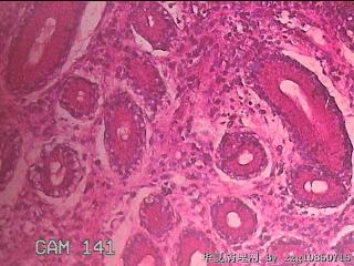 胃窦粘膜图27