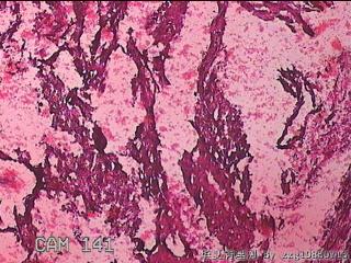 胎盘胎膜组织图14
