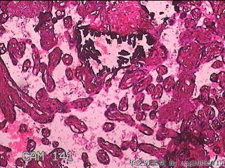胎盘胎膜组织图16