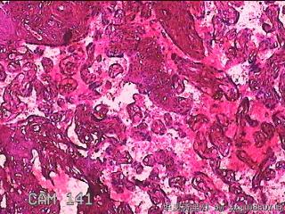 胎盘胎膜组织图18