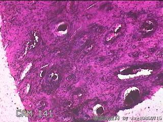 宫颈组织图18