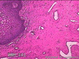 宫颈组织图25