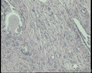 请老师看看前列腺增生纤维间质间这些蓝染的是什么？图6