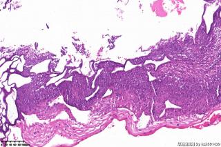 CIN1?图5