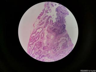 胃窦粘膜图3