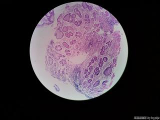 胃窦粘膜图9