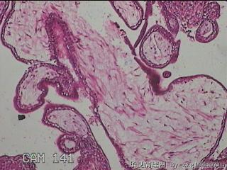 宫腔组织图15