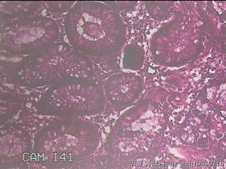 直乙结肠粘膜图24