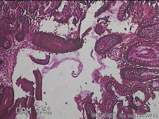 直乙结肠粘膜图15