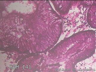 直乙结肠粘膜图19