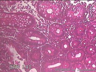 直乙结肠粘膜图1