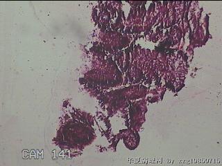 直乙结肠粘膜图5