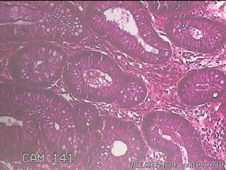 直乙结肠粘膜图30