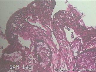 直乙结肠粘膜图16