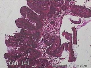 直乙结肠粘膜图12