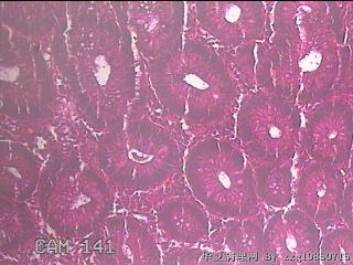 直乙结肠粘膜图27