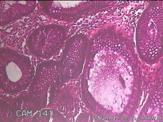直乙结肠粘膜图32