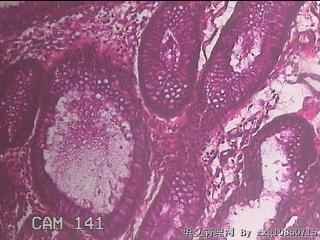 直乙结肠粘膜图2