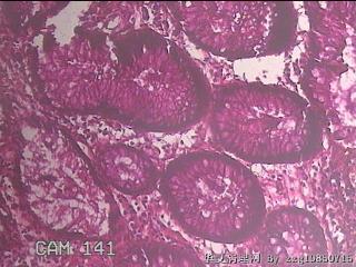 直乙结肠粘膜图23
