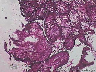 直乙结肠粘膜图8