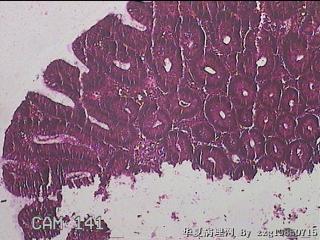 直乙结肠粘膜图11