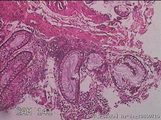 直肠粘膜图14