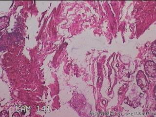 直肠粘膜图13