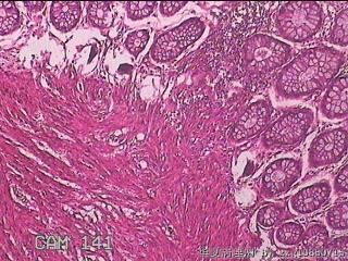直肠粘膜图6