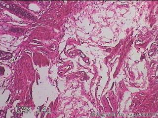直肠粘膜图12