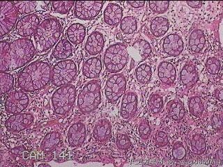直肠粘膜图19