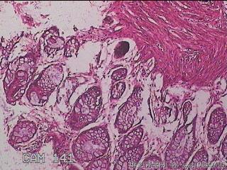 直肠粘膜图9