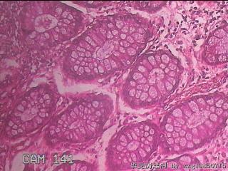 直肠粘膜图2