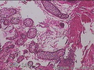直肠粘膜图16
