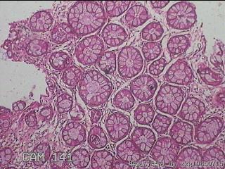 直肠粘膜图21