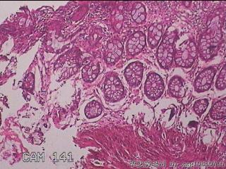 直肠粘膜图10