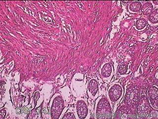 直肠粘膜图7