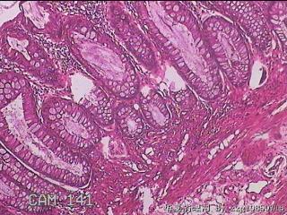 直肠粘膜图11