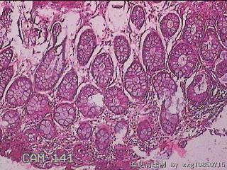直肠粘膜图8
