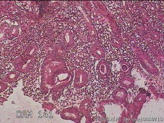 胃窦粘膜图3