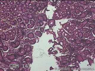 胃体下段粘膜图2