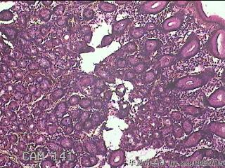 胃体下段粘膜图1