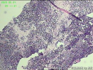 颈部穿刺标本，请教？图3
