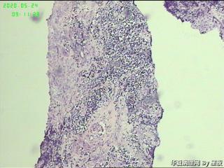 颈部穿刺标本，请教？图2