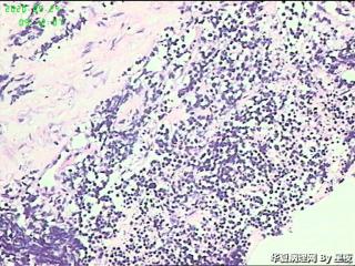 颈部穿刺标本，请教？图6